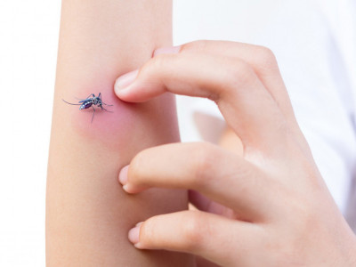 SAVETI LEKARA: Uz ovih nekoliko trikova rešite se bola i svraba od UJEDA komarca