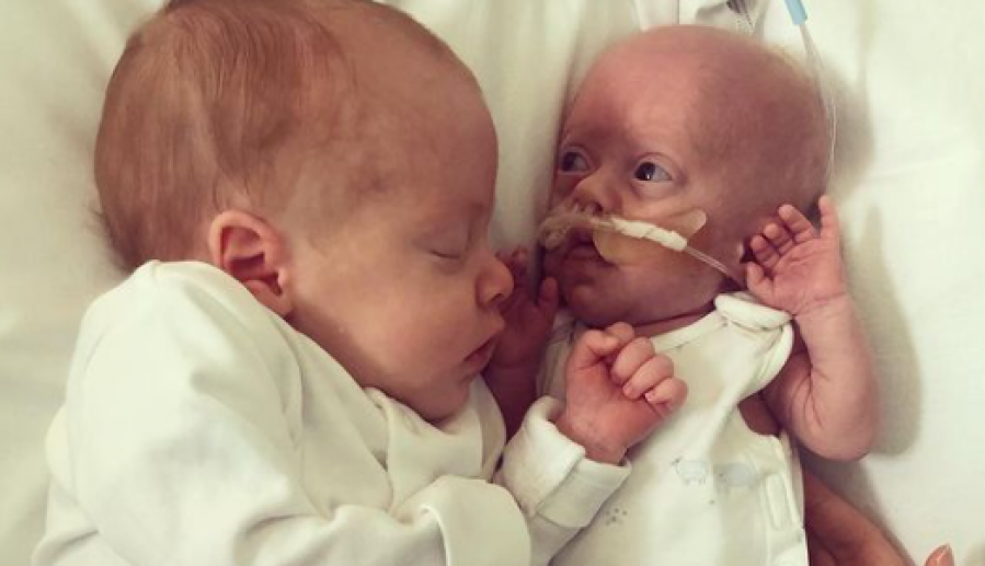 Prerano rođeni dečak se bori za život: Zastaće vam dah kad vidite šta njegov brat blizanac radi za njega