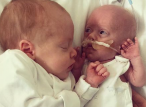 Prerano rođeni dečak se bori za život: Zastaće vam dah kad vidite šta njegov brat blizanac radi za njega