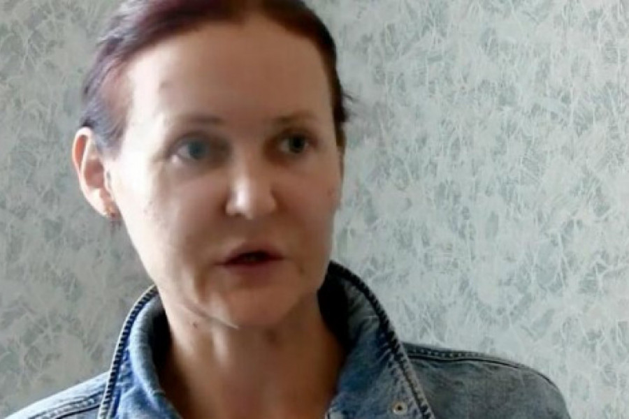 Samo JEDAN zahvat na licu uništio je ZAUVEK: Svetlana (37) dobila je izgled iz najgorih košmara, zbog ovoga se gorko kaje!