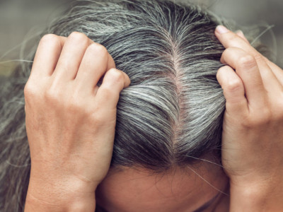 Seda kosa govori DOSTA o vašem ZDRAVLJU: U jednom SLUČAJU simptom je ozbiljne BOLESTI, na ovo treba da obratite pažnju