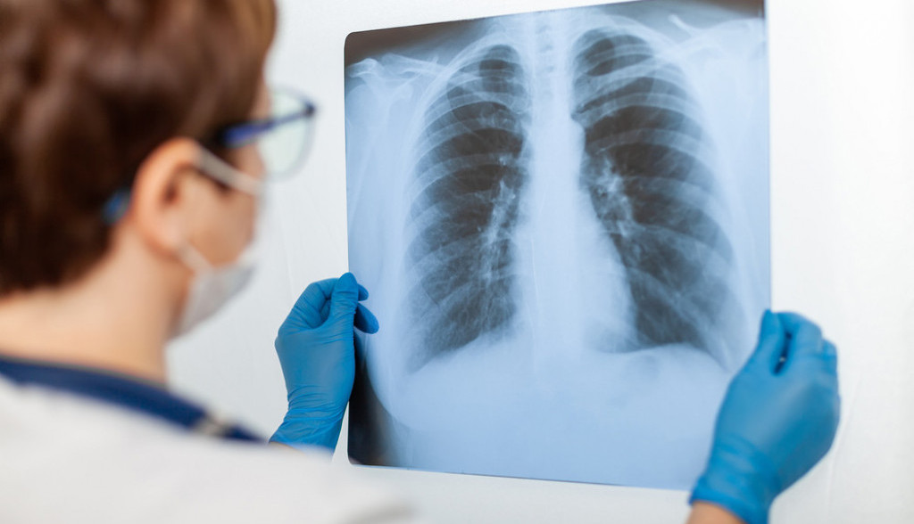 UPALU pluća možete otkriti u TOALETU: Na ovaj SIMPTOM niko ne obraća pažnju, a može da bude znak OPASNE infekcije