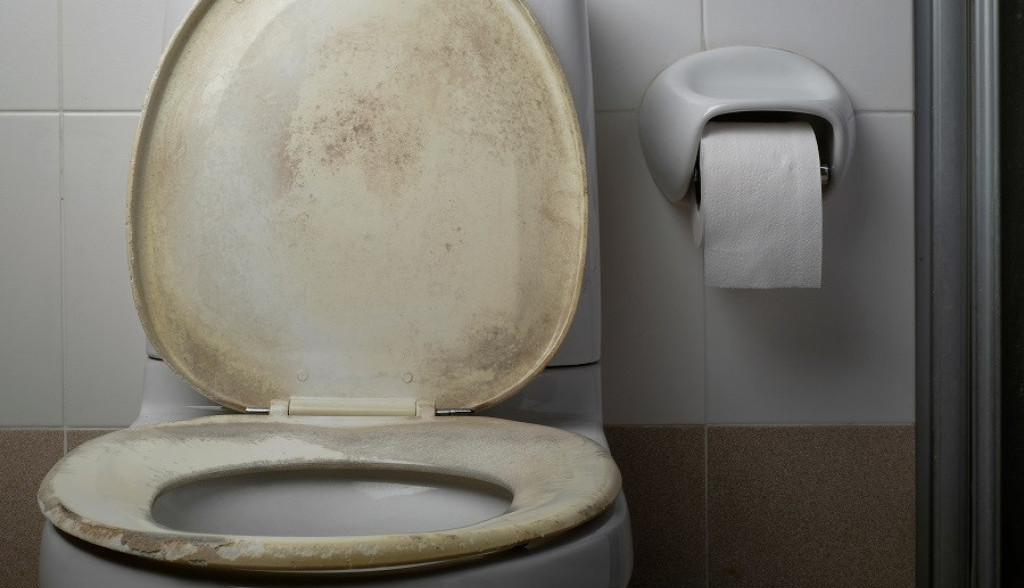 Trik koji svaka DOMAĆICA mora da zna: Kako ukloniti ŽUTE mrlje sa toaletne daske uz pomoć samo jednog proizvoda iz kuhinje