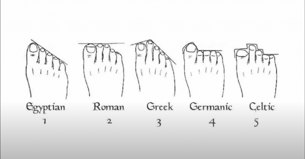 Zanima vas da li ste EGIPATSKOG, GERMANSKOG, RIMSKOG ILI KELTSKOG porekla? Potrebno je da smo pogledate svoje stopalo i SAZNATE!