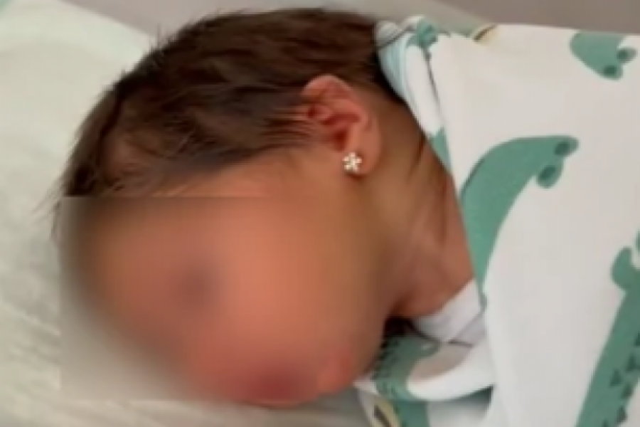 "Probušili su joj uši pre nego što su presekli pupčanu vrpcu": Hajka na mladu MAJKU zbog bebinih minđuša!