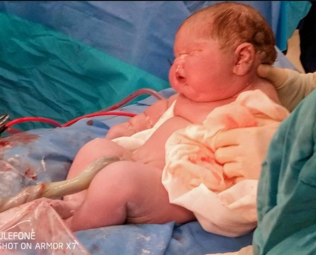 Rodilo se TREĆE NAJTEŽE novorođenče u SVETU: Babice su počele da ga FOTOGRAFIŠU, niko nije video TOLIKU bebu, ali su ga prozvale POGRDNIM nadimkom