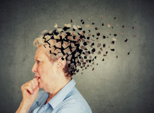 Prvi SIMPTOMI su se pojavili 10 godina ranije: Ova bolest oduzima pamćenje, uništava mozak, ne može da se IZLEČI