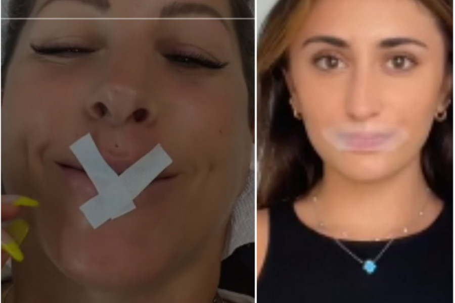Žene u svetu su POLUDELE za TRIKOM koji je opasan po ZDRAVLJE: Lepe USNE da bi podstakle DISANJE na nos tokom noći