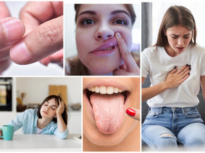 U ustima i na NOKTIMA se može videti nedostatak MINERALA: Ovo su samo NEKI simptomi da je vaše zdravlje OZBILJNO narušeno