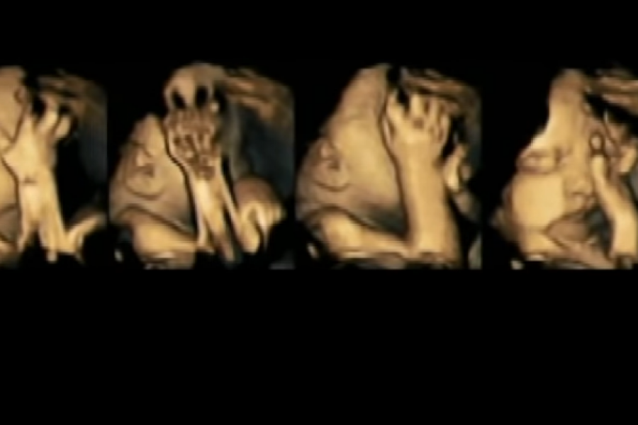 Pogledajte kako BEBA reaguje kada trudnica zapali CIGARETU: Uznemirujuć VIDEO kako se beba bori za VAZDUH!