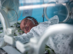 Žena je rodila bebu koja je imala samo 500 grama: 